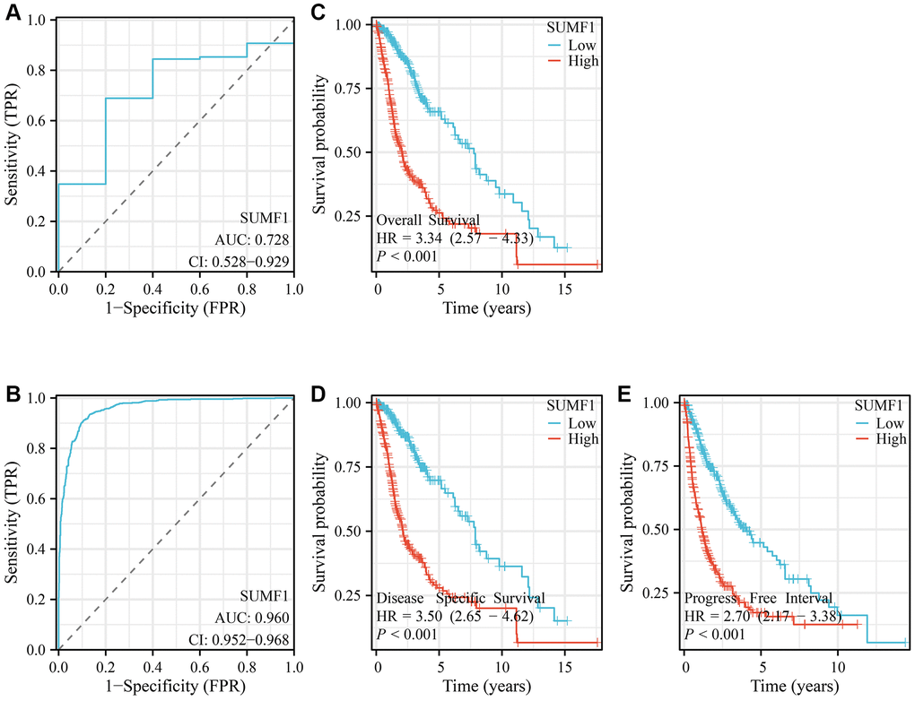 SUMF1 overexpression can be used as a diagnostic and prognostic tool in the treatment of glioma. (A) The AUC of SUMF1 from the TCGA database; (B) The AUC of SUMF1 from the XNEA database; (C–E) SUMF1 overexpression is predictive of poor prognosis.